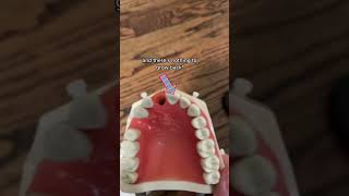 Here’s what happens when your tooth falls out! #dentist #babyteeth #braces #brushyourteeth #smile