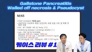 [췌담도질환 바로알기⑥ │Case Discussion 1 -Gallstone pancreatitis [대한췌장담도학회]