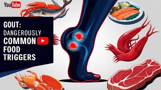 Gout: Dangerously Common Food Triggers