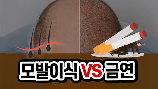 #19. 모발이식 후, 금연해야할까?