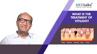 What is the treatment of vitiligo? | Dr Dr J S Pasricha | Medtalks