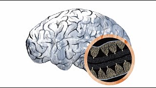 Inside the autism brain: The cerebellum