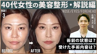 40代女性の鼻と目元の美容整形、佐藤大介医師が手術内容を解説！③ リッツ美容外科