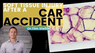 SOFT TISSUE INJURY AFTER CAR ACCIDENT