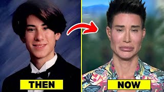 15 Shocking Male Celebrities’ Plastic Surgery Transformations | Then and Now 2026