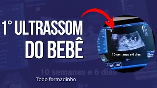 1° ultrassom   do bebê 10 semanas e 6 dias  ❤️🤩❤️