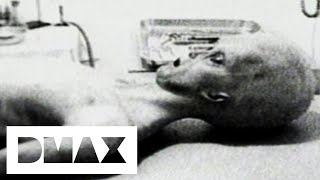 Video Footage Of An Alien Autopsy Sheds Light Over UFO Mystery | World's Strangest UFO Stories