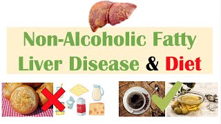 Non-Alcoholic Fatty Liver Disease & Diet | Diets to Prevent and Reduce Severity of NAFLD