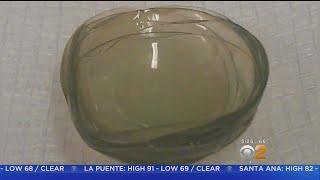 Doctors Find 27 Contact Lenses Clumped In Woman's Eye
