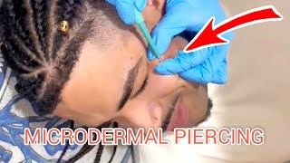 How is a MICRODERMAL piercing done, DERMAL piercing on FACE