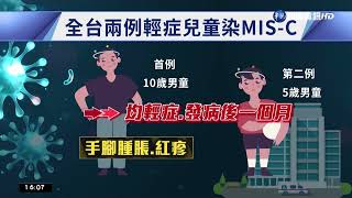 全台第2例! 童癒後罹\