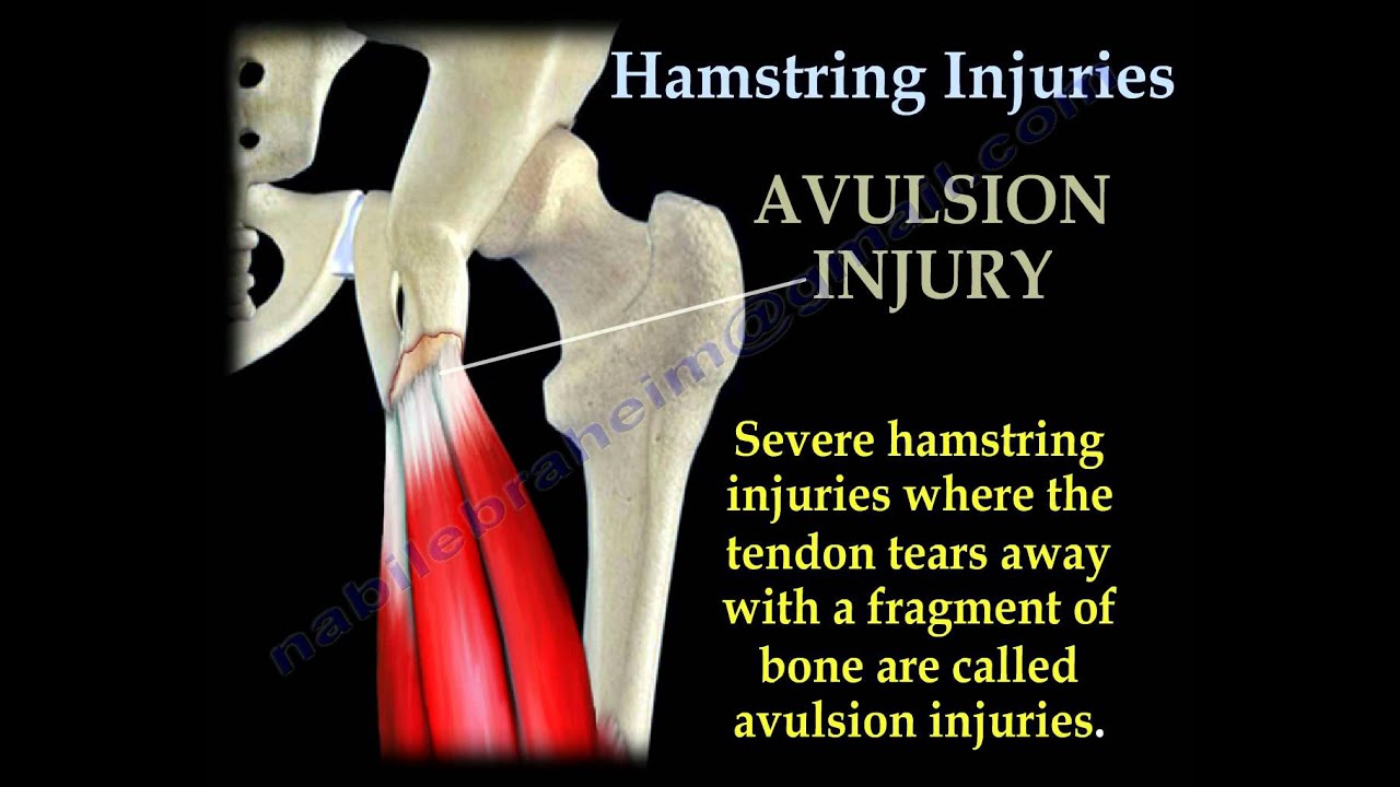 Human Hamstring Muscle