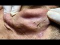 Satisfying video with Chung Vo Spa #135