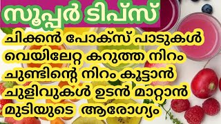 5 പൈസ മുടക്കാതെ ഈ സൗന്ദര്യ പ്രശ്നങ്ങൾ വീട്ടിൽ പരിഹരിക്കാം!