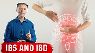 FODMAPS and Irritable Bowel Syndrome