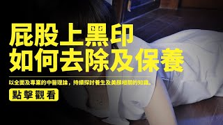 屁股上有“黑印子”，怎麼都洗不乾淨，怎麼回事教你如何淡化