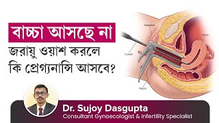 বাচ্চা আসছে না, জরায়ু ওয়াশ করলে কি প্রেগ্যনান্সি আসবে? Ovulation Induction or Dilation \u0026 Curettage