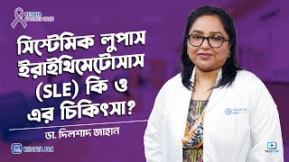 SLE এর সমস্যা ও ট্রিট্মেন্ট / Systemic Lupus Erythematosus (SLE)