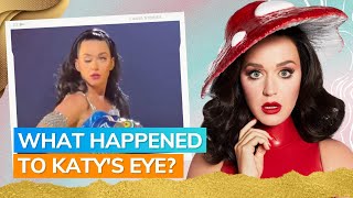 Fans Concerned For Katy Perry After Eye Malfunction