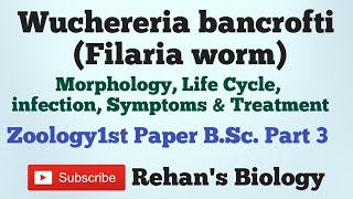 #Wuchereria bancrofti #Filaria Worm #Filariasis  #Rehan's Biology #B.Sc.part 3 Zoology1st