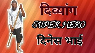 DIVYANG DINESH BHAI || एक दिव्यांग की कहानी || HANDICAP MOTIVATIONAL STORY || PHYSICALLY HANDICAPPED