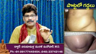 Swellings in Abdomen, Causes and Ayurvedic Treatments in Telugu by Dr. Murali Manohar, M.D.