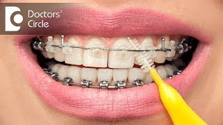 Ways to use an interdental brush - Dr. Aniruddha KB