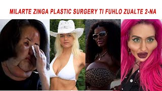 Celebrity zinga  Plastic Surgery ti fuhlo zualte -2 - na