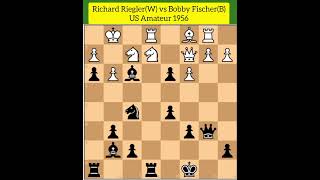 Bobby Fischer's Opponent Try to Fight til the End But Cannot Bear the Pain!!! Really Fat Brain