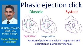 Phasic ejection click