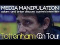 Contes interview and media manipulation