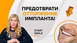 Имплантация зубов: главные ошибки после операции!