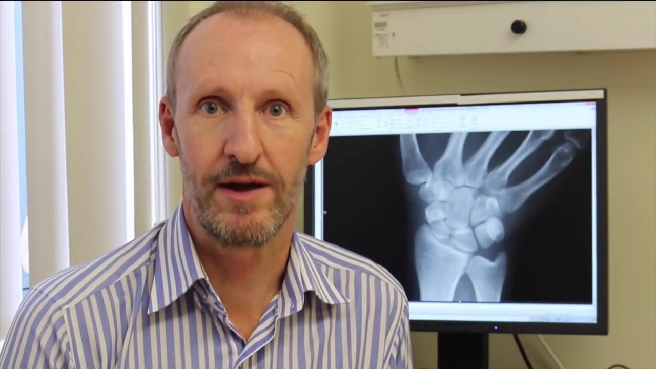 New Virtual Fracture Clinic - YouTube