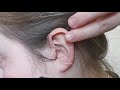 How to insert your hearing aid