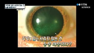 추운 겨울 뜨거운 음식을 먹을 때 각막에 김이 서리지 않는 이유는? / YTN 사이언스