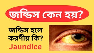 জন্ডিস কেন হয়? জন্ডিসের লক্ষণ কি কি? জন্ডিস হলে করণীয় কি? Jaundice