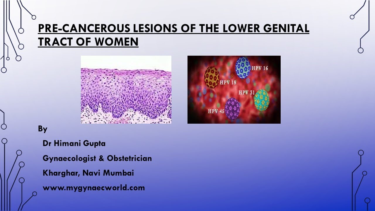 Preinvasive/Precancerous Lesions Of The Lower Genital Tract Of Women ...