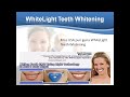 pemutih gigi whitelight teeth whitening