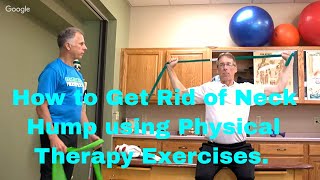 How to Get Rid of Neck Hump using Physical Therapy Posture Exercises