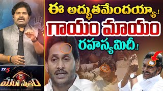 Maro Netram : గాయం మాయం రహస్యమిదీ | Mystery behind jagan wound heals | TV5 News