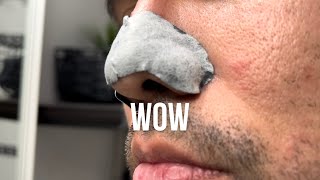 #Skincare #blackhead pore strip on the nose that turned out to be a lot. #ASMR