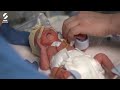 Premature Baby Alfie Arrives Three Months Early   Tiny Lives Series 2  BBC Scotland