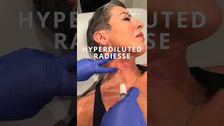 Hyperdiluted Radiesse in the neck / chest stimulates collagen \u0026 elastin production #dermalfiller