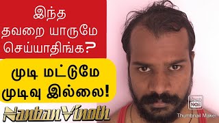 Hair Fall Problems? | இந்த தவறை யாரும் செய்யாதிங்க? முடி மட்டுமே முடிவு இல்லை! Nanbanvinoth HT