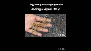 வழுக்கை தலையில் முடி வளர#hairgrowthtips#shorts#shortsfeed#tips#tricks#haircare #trending#lifehacks