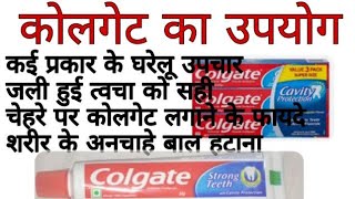 कोलगेट से क्या-क्या फायदे हैं | जली हुई त्वचा पर कोलगेट का फायदा Toothpaste lagana ke fayeda