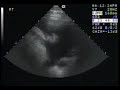 Thoroughbred Horse with Pleuropneumonia Ultrasound | Merck Veterinary Manual