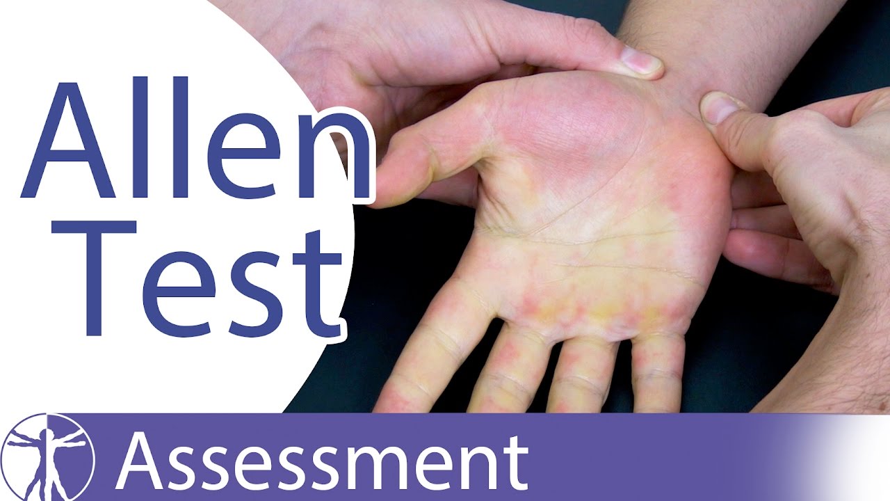 Allen Test Anatomy