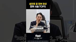 황금연휴에 몰래 예뻐지는 피부 시술 TOP5!