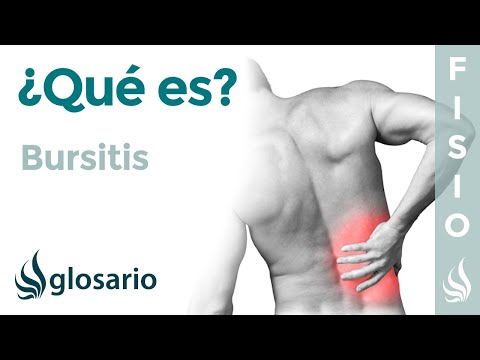 Bursitis De Hombro: Causas, Síntomas Y Baja Laboral - CCFProsario.com.ar